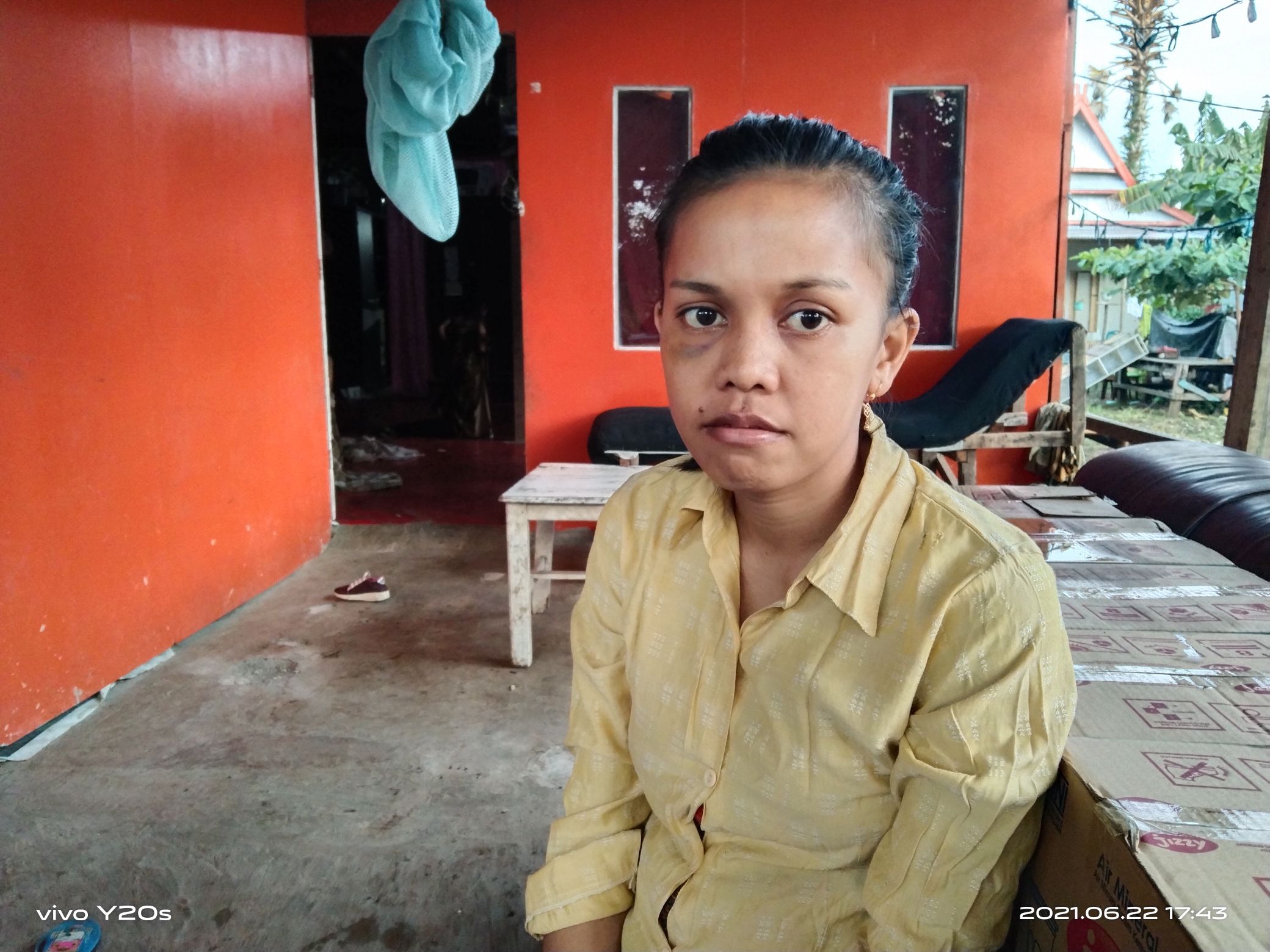 Tak Jelas Penanganan Lakalantas di Cikoang? Ini Kata Kapolres Takalar